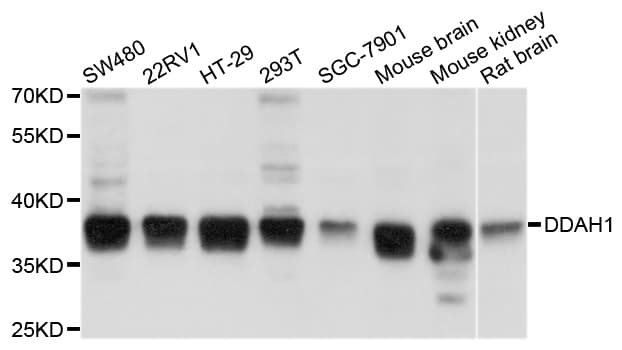 DDAH1 Antibody