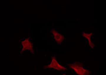 CDKN2B / p15 INK4b Antibody