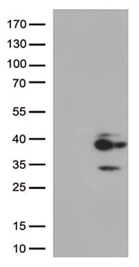 Monoclonal Mouse anti-Human PRG2 / Proteoglycan 2 Antibody (clone OTI10D10, aa17-222, WB)