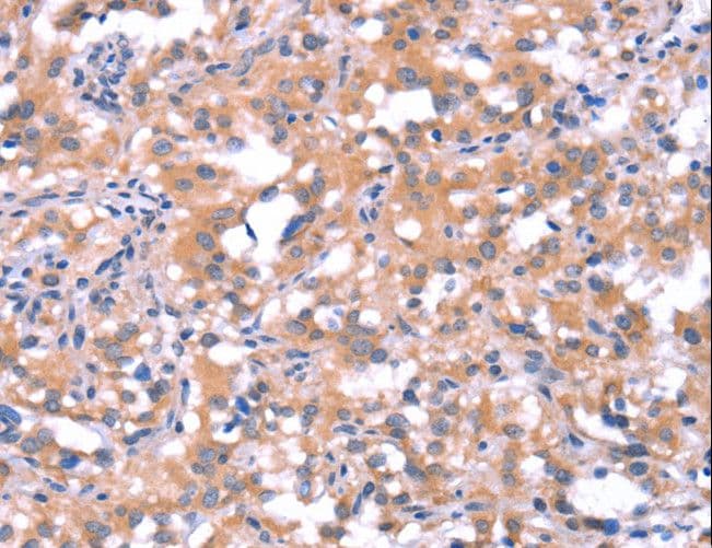 FAT1 / FAT Antibody