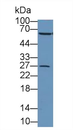 CAT / Catalase Antibody (aa32-167)