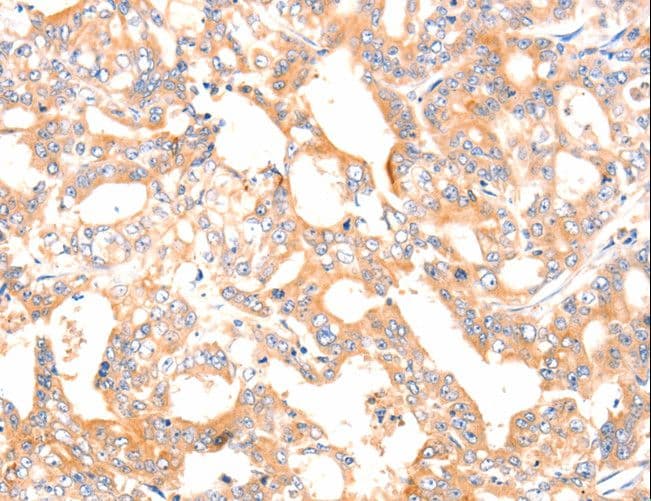 F13A1 / Factor XIIIa Antibody