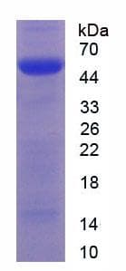 Human MYH2 Protein (Recombinant His-GST, N-terminus)