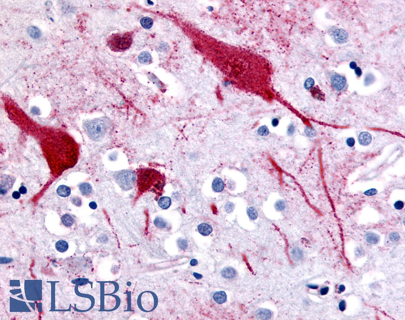 IHC-plus™ SLC5A9 / SGLT4 Antibody (C-Terminus)