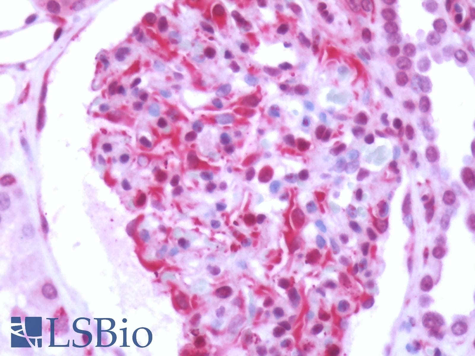 IHC-plus™ Polyclonal Rabbit anti-Human RAIG2 / GPRC5B Antibody (N-Terminus, IHC)
