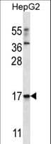 TRIM48 / RNF101 Antibody (aa42-71)
