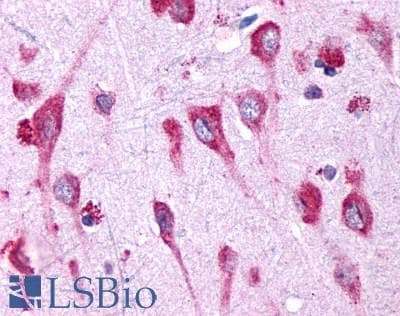 PathPlus™ Polyclonal Rabbit anti-Human GPR146 Antibody (C-Terminus, IHC)