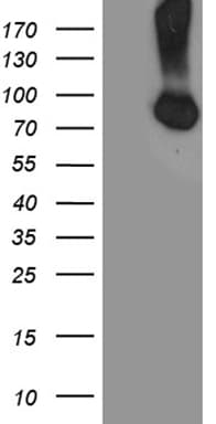 Monoclonal Mouse anti-Human CFI / Complement Factor I Antibody (clone OTI3C1, aa340-583, WB)