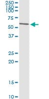 SMARCE1 / BAF57 Antibody (clone 6G11)