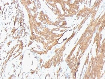 Muscle Actin Antibody (clone HHF35 + MSA/953)