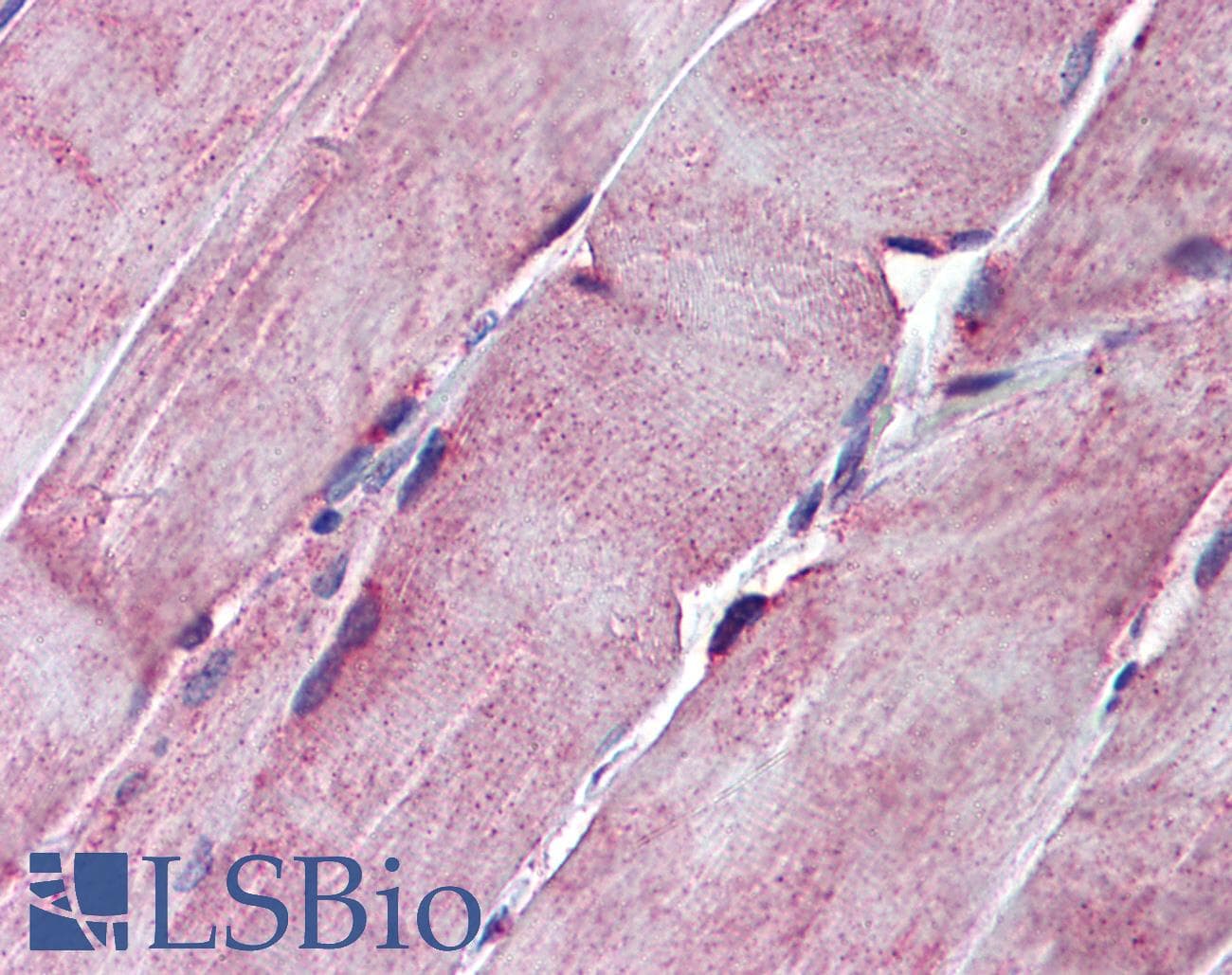 SGCE Antibody (aa36-85)