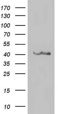 Monoclonal Mouse anti-Human CD34 Antibody (clone OTI39B1, IHC, WB)