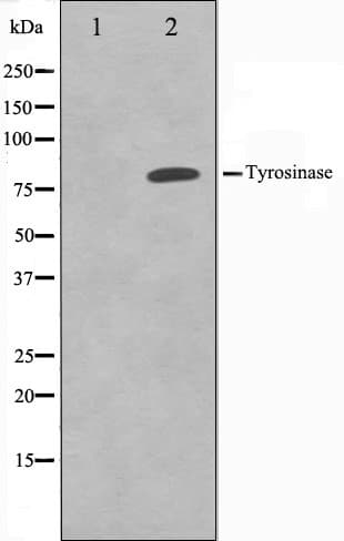 Tyrosinase Antibody
