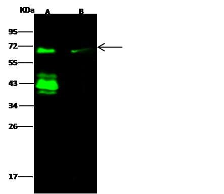 Polyclonal Rabbit anti-Human ER Alpha / Estrogen Receptor Antibody (Preservative Free, IF, WB)