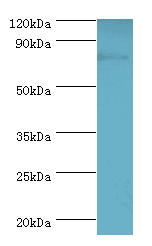 Polyclonal Rabbit anti-Human ADRBK1 / GRK2 Antibody (aa440-689, WB)