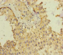 Polyclonal Rabbit anti-Human SH3GL3 Antibody (IHC)