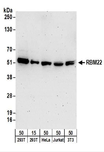 IHC-plus™ RBM22 Antibody (aa175-225)