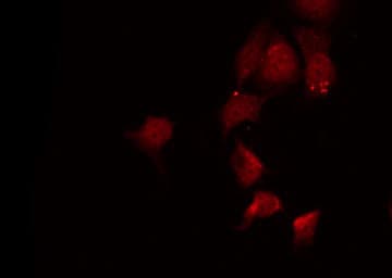 Polyclonal Rabbit anti-Human AKT1 Antibody (IF, WB)