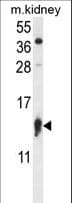 IHC-plus™ RPS12 / Ribosomal Protein S12 Antibody (aa15-44)