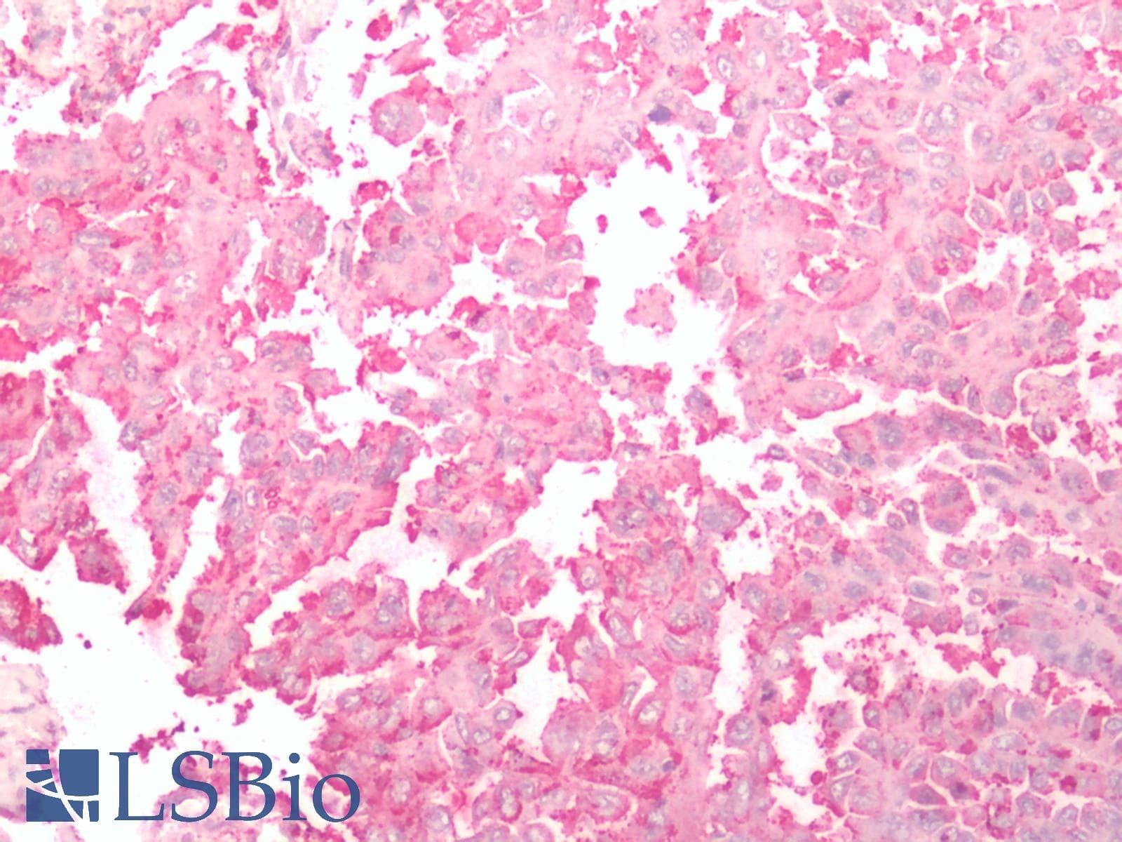 IHC-plus™ Polyclonal Rabbit anti-Human FZD2 / Frizzled 2 Antibody (N-Terminus, IHC)