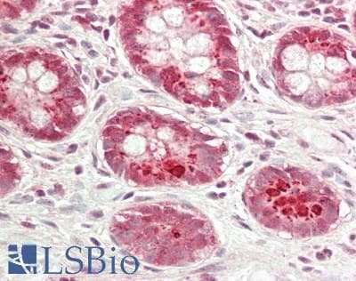 IHC-plus™ HSPA8 / HSC70 Antibody (Internal, clone 6C7)