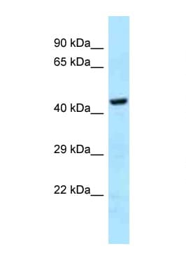 GHDC Antibody (aa70-119)