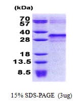 Human IGFBP6 Protein (Recombinant His)
