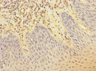 CR1 / CD35 Antibody (aa420-550)