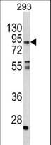 Polyclonal Rabbit anti-Human CCHCR1 Antibody (aa599-627, IHC, IF, WB)
