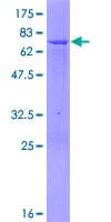 Human PCYT1A / CCT Alpha Protein (Recombinant GST)