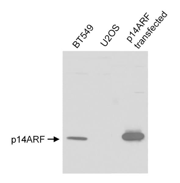 p14ARF / CDKN2A Antibody (aa75-125)