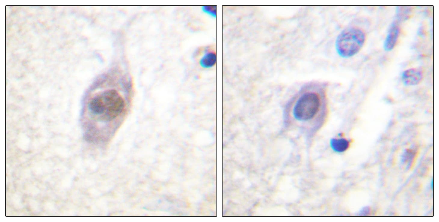 Polyclonal Rabbit anti-Human APC Antibody (aa2020-2069, IHC)