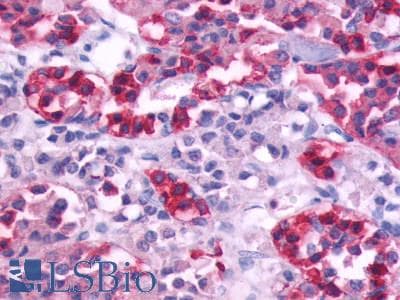PathPlus™ CHRM5 / M5 Antibody (Cytoplasmic Domain)