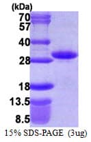 Human RND1 Protein (Recombinant His)