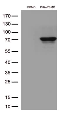 LAG3 Antibody (aa66-332, clone OTI3C6)