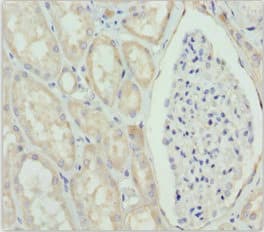 GNS Antibody