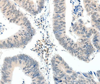 Polyclonal Rabbit anti-Human TRAF7 Antibody (IHC, WB)