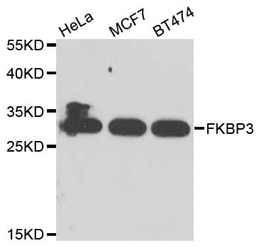 FKBP25 / FKBP3 Antibody