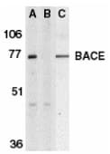 BACE1 / BACE Antibody