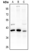 Polyclonal Rabbit anti-Human PDIK1L Antibody (IHC, WB)