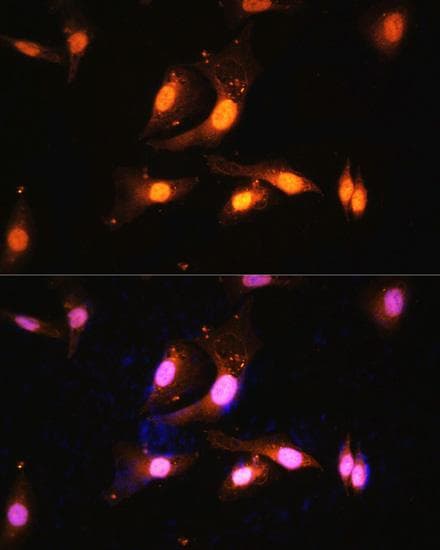 FLCN / Folliculin Antibody