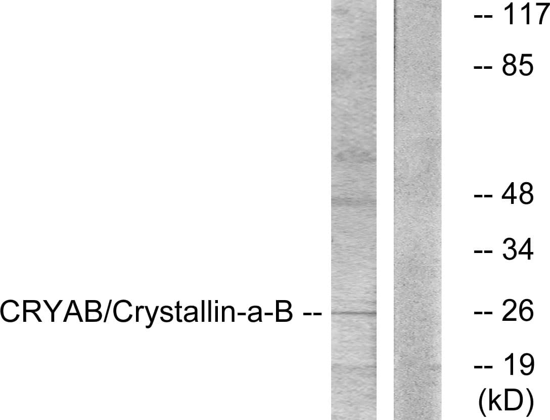 IHC-plus™ CRYAB / Alpha B Crystallin Antibody (aa31-80)