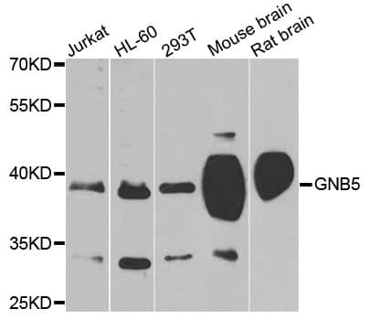 GB5 / GNB5 Antibody