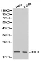 Polyclonal Rabbit anti-Human DHFR Antibody (IHC, WB)