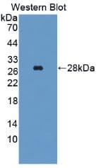 GPT / Alanine Transaminase Antibody (aa367-480)