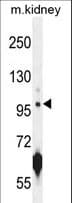 CARNS1 Antibody (aa239-268)