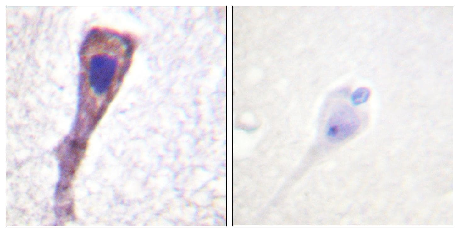 PBK / TOPK Antibody (p9)