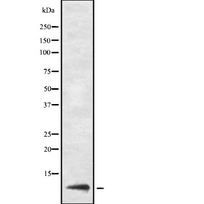 URM1 Antibody