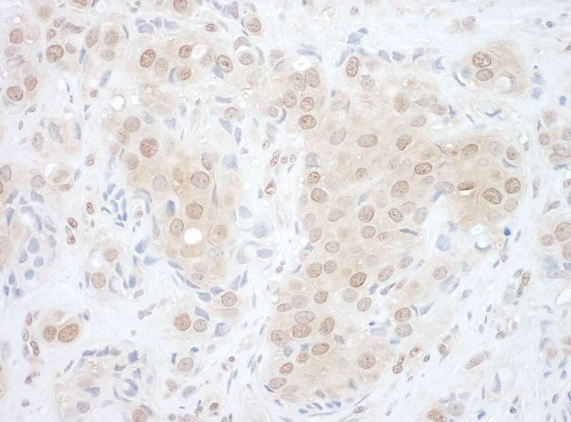 EYA2 Antibody (aa1-50)