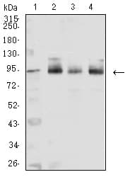 CTNNB1 / Beta Catenin Antibody (clone 7C5A2)